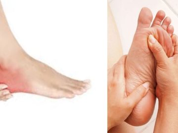 Heel pain causes