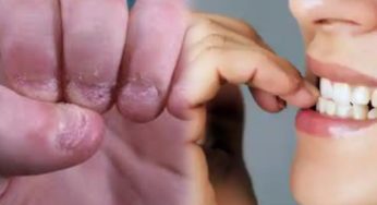 ناخن چبانا ایک نفسیاتی بیماری کیسے بچا جاسکتا ہے؟