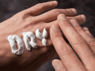 Winter Dry Skin Problems