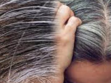 Hair Turning White Before Time