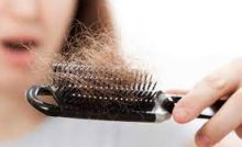 Hair Loss Causes